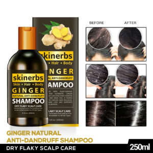 SKINERBS™ Ginger Natural Anti Dandruff Shampoo