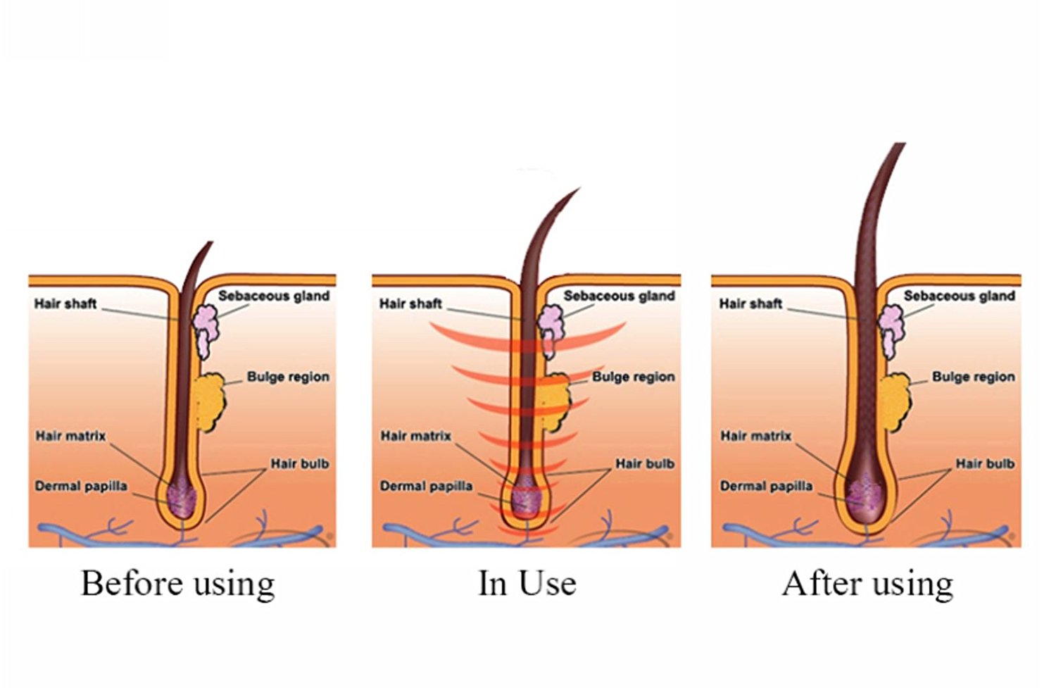 Dexe Hair Thick Anti Hair Loss Shampoo Hair Grower 200ml - Image 5