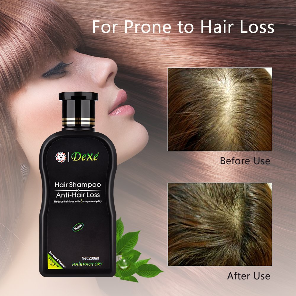 DEXE Anti Hair Loss Shampoo With Advance Formula 200ml - Image 5