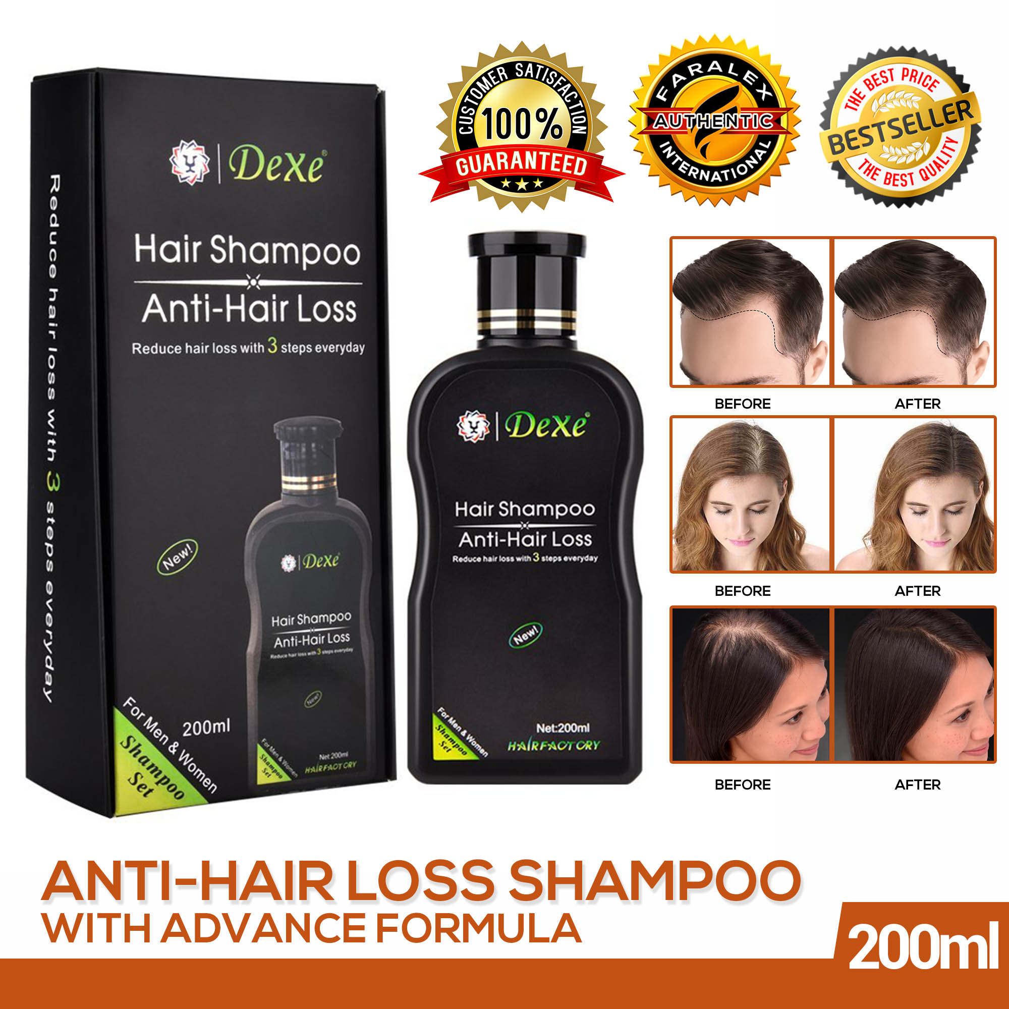 DEXE Anti Hair Loss Shampoo With Advance Formula 200ml