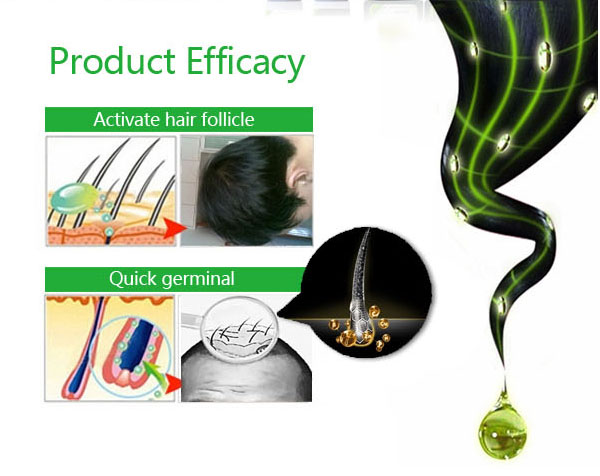 Dexe Hair Thick Anti Hair Loss Shampoo Hair Grower 200ml - Image 4