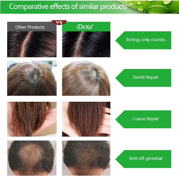 Dexe Hair Thick Anti Hair Loss Shampoo Hair Grower 200ml - Image 2